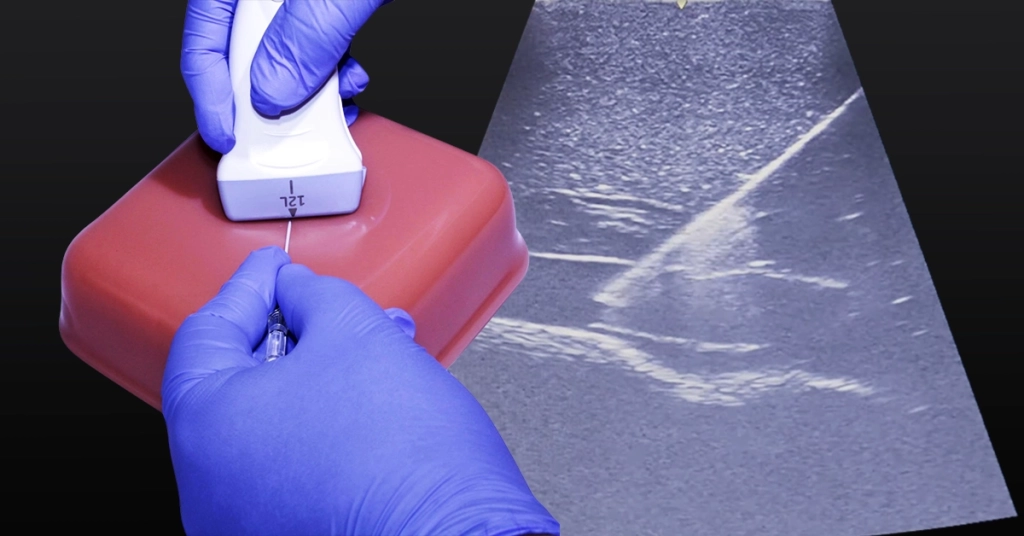 ultrasound probe
