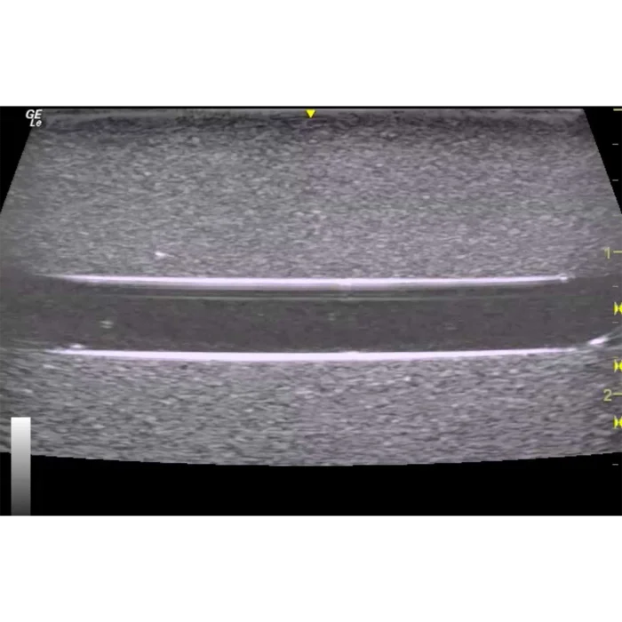 Orientation Ultrasound Phantom Trainer - Image 6