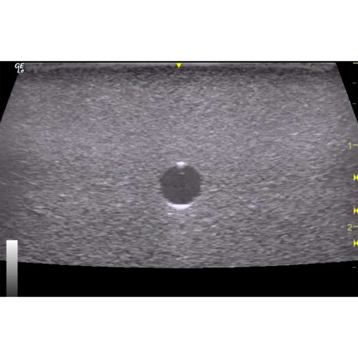 Orientation Ultrasound Phantom Trainer - Image 7