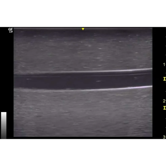 Hm4.0 Reusable 4 Vessel Ultrasound Phantom Training - Image 10