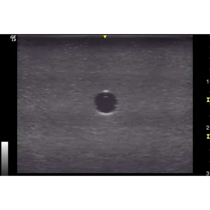 Hm4.0 Reusable 4 Vessel Ultrasound Phantom Training - Image 9