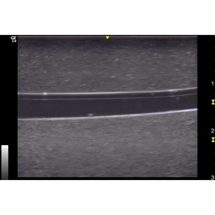 Hm4.0 Reusable 4 Vessel Ultrasound Phantom Training - Image 8