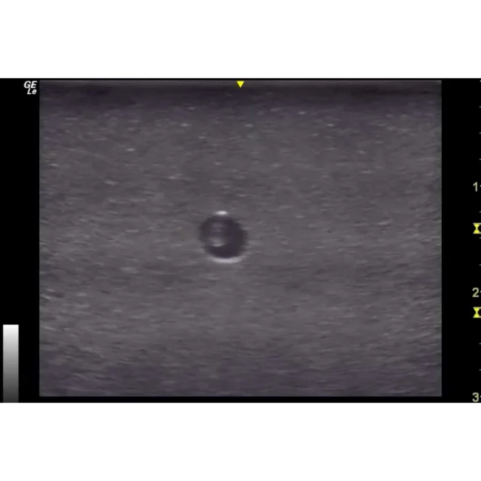 Hm4.0 Reusable 4 Vessel Ultrasound Phantom Training - Image 7