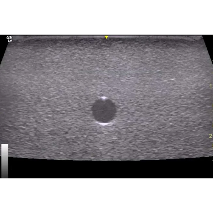 Hm4.0 Reusable 4 Vessel Ultrasound Phantom Training - Image 6