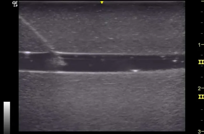 3 Vessel Ultrasound Phantom Trainer - Image 11