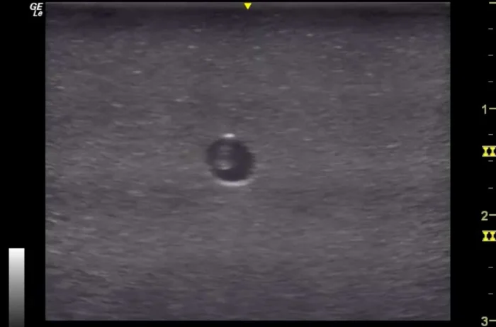 3 Vessel Ultrasound Phantom Trainer - Image 8