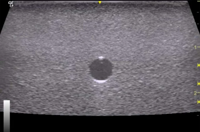 Hm2.0 Re-Moldable 2 Vessel Ultrasound Training Model - Image 12