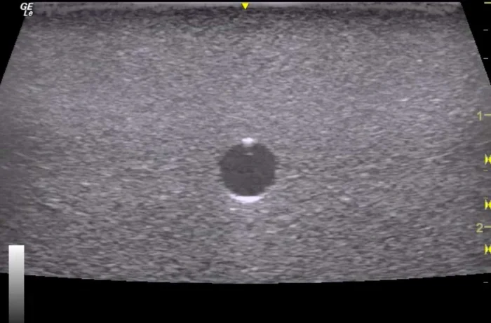 3 Vessel Ultrasound Phantom Trainer - Image 9