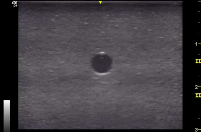 3 Vessel Ultrasound Phantom Trainer - Image 7