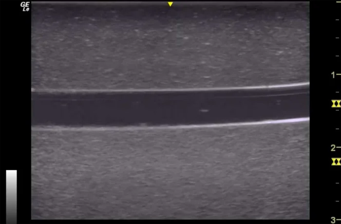 Hm2.0 Re-Moldable 2 Vessel Ultrasound Training Model - Image 7