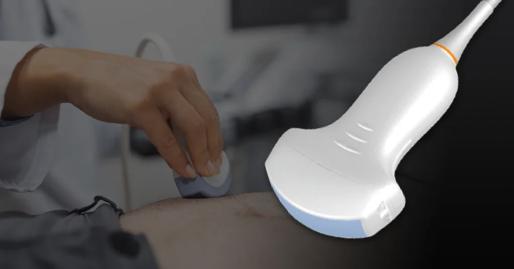 Medical ultrasound procedure showing handheld transducer and gel application on patient.